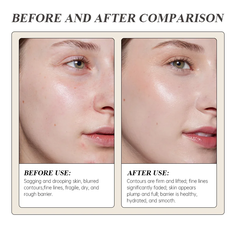 Before-and-after image showing skin transformation with reduced fine lines, improved hydration, and a smoother texture.